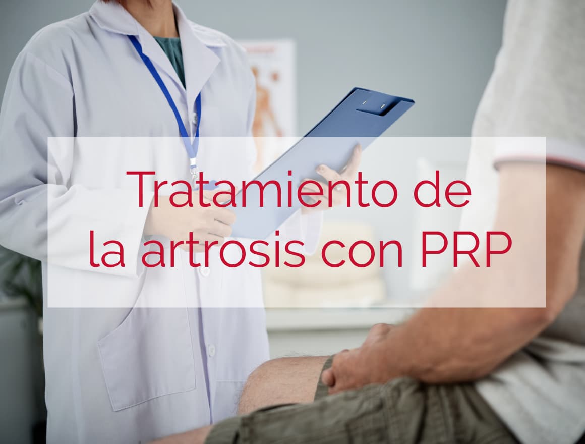 Tratamiento artrosis con prp