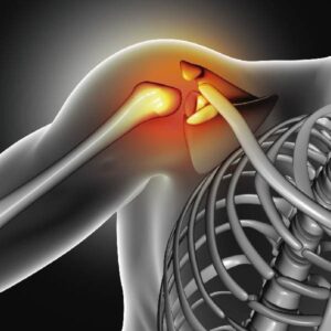 dolor artritis reumatoide